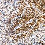TRMT61A Antibody in Immunohistochemistry (Paraffin) (IHC (P))