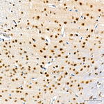 TRMT61A Antibody in Immunohistochemistry (Paraffin) (IHC (P))