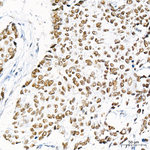 TRMT61A Antibody in Immunohistochemistry (Paraffin) (IHC (P))