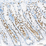TRMT61A Antibody in Immunohistochemistry (Paraffin) (IHC (P))