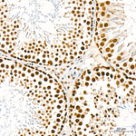 TRMT61A Antibody in Immunohistochemistry (Paraffin) (IHC (P))