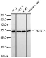 TRMT61A Antibody in Western Blot (WB)