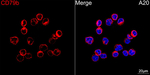 CD79b Recombinant Rabbit Monoclonal Antibody (8M5D2)