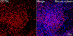 CD79b Antibody in Immunohistochemistry (Paraffin) (IHC (P))