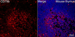 CD79b Antibody in Immunohistochemistry (Paraffin) (IHC (P))