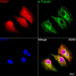 NNMT Recombinant Rabbit Monoclonal Antibody (1R5Z1)