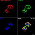 TRAIL Recombinant Rabbit Monoclonal Antibody (1J5S5)