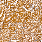 TRAIL Antibody in Immunohistochemistry (Paraffin) (IHC (P))