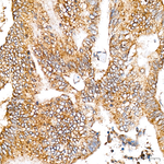 TRAIL Antibody in Immunohistochemistry (Paraffin) (IHC (P))