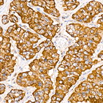 TRAIL Antibody in Immunohistochemistry (Paraffin) (IHC (P))