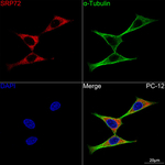 SRP72 Recombinant Rabbit Monoclonal Antibody (5Q0Y8)