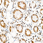 SRP72 Antibody in Immunohistochemistry (Paraffin) (IHC (P))