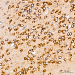 SRP72 Antibody in Immunohistochemistry (Paraffin) (IHC (P))