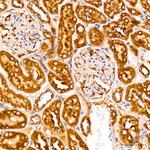 SRP72 Antibody in Immunohistochemistry (Paraffin) (IHC (P))