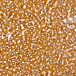 SRP72 Antibody in Immunohistochemistry (Paraffin) (IHC (P))