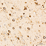 SRP72 Antibody in Immunohistochemistry (Paraffin) (IHC (P))