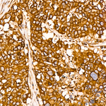 SRP72 Antibody in Immunohistochemistry (Paraffin) (IHC (P))