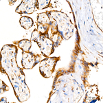 SRP72 Antibody in Immunohistochemistry (Paraffin) (IHC (P))