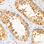 SRP72 Antibody in Immunohistochemistry (Paraffin) (IHC (P))