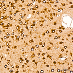 SRP72 Antibody in Immunohistochemistry (Paraffin) (IHC (P))