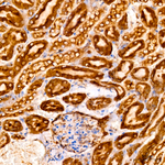 SRP72 Antibody in Immunohistochemistry (Paraffin) (IHC (P))