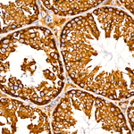 SRP72 Antibody in Immunohistochemistry (Paraffin) (IHC (P))