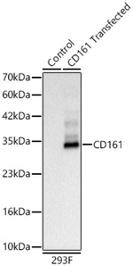 KLRB1 Antibody in Western Blot (WB)