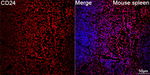 CD24 Antibody in Immunohistochemistry (Paraffin) (IHC (P))