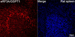 GSPT1 Antibody in Immunohistochemistry (Paraffin) (IHC (P))