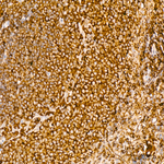 GSPT1 Antibody in Immunohistochemistry (Paraffin) (IHC (P))