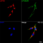 eIF4E Antibody in Immunocytochemistry (ICC/IF)