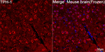 TPH1 Antibody in Immunohistochemistry (Frozen) (IHC (F))