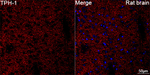 TPH1 Antibody in Immunohistochemistry (Paraffin) (IHC (P))