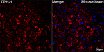 TPH1 Recombinant Rabbit Monoclonal Antibody (5P6K8)