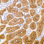 TPH1 Antibody in Immunohistochemistry (Paraffin) (IHC (P))