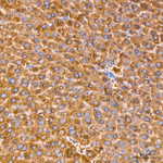TPH1 Antibody in Immunohistochemistry (Paraffin) (IHC (P))