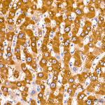 TPH1 Antibody in Immunohistochemistry (Paraffin) (IHC (P))