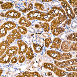 TPH1 Antibody in Immunohistochemistry (Paraffin) (IHC (P))