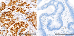 MSH6 Antibody in Immunohistochemistry (Paraffin) (IHC (P))