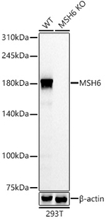 MSH6 Antibody in Western Blot (WB)