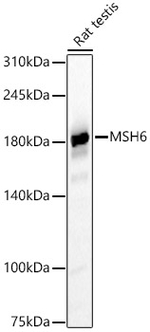 MSH6 Antibody in Western Blot (WB)