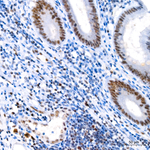 MLH1 Antibody in Immunohistochemistry (Paraffin) (IHC (P))