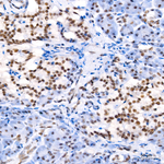 MLH1 Antibody in Immunohistochemistry (Paraffin) (IHC (P))