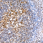 MLH1 Antibody in Immunohistochemistry (Paraffin) (IHC (P))