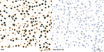 MLH1 Antibody in Immunohistochemistry (Paraffin) (IHC (P))