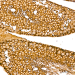 AGO2 Antibody in Immunohistochemistry (Paraffin) (IHC (P))