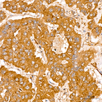 AGO2 Antibody in Immunohistochemistry (Paraffin) (IHC (P))