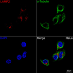 LAMP2 Recombinant Rabbit Monoclonal Antibody (9Y1M6)