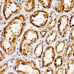 LAMP2 Antibody in Immunohistochemistry (Paraffin) (IHC (P))