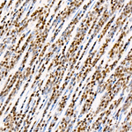 T-bet Antibody in Immunohistochemistry (Paraffin) (IHC (P))